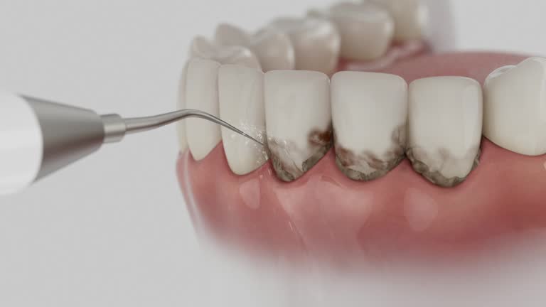 Reliable Dental contractor in Murphy, NC by Smile Center Dentistry